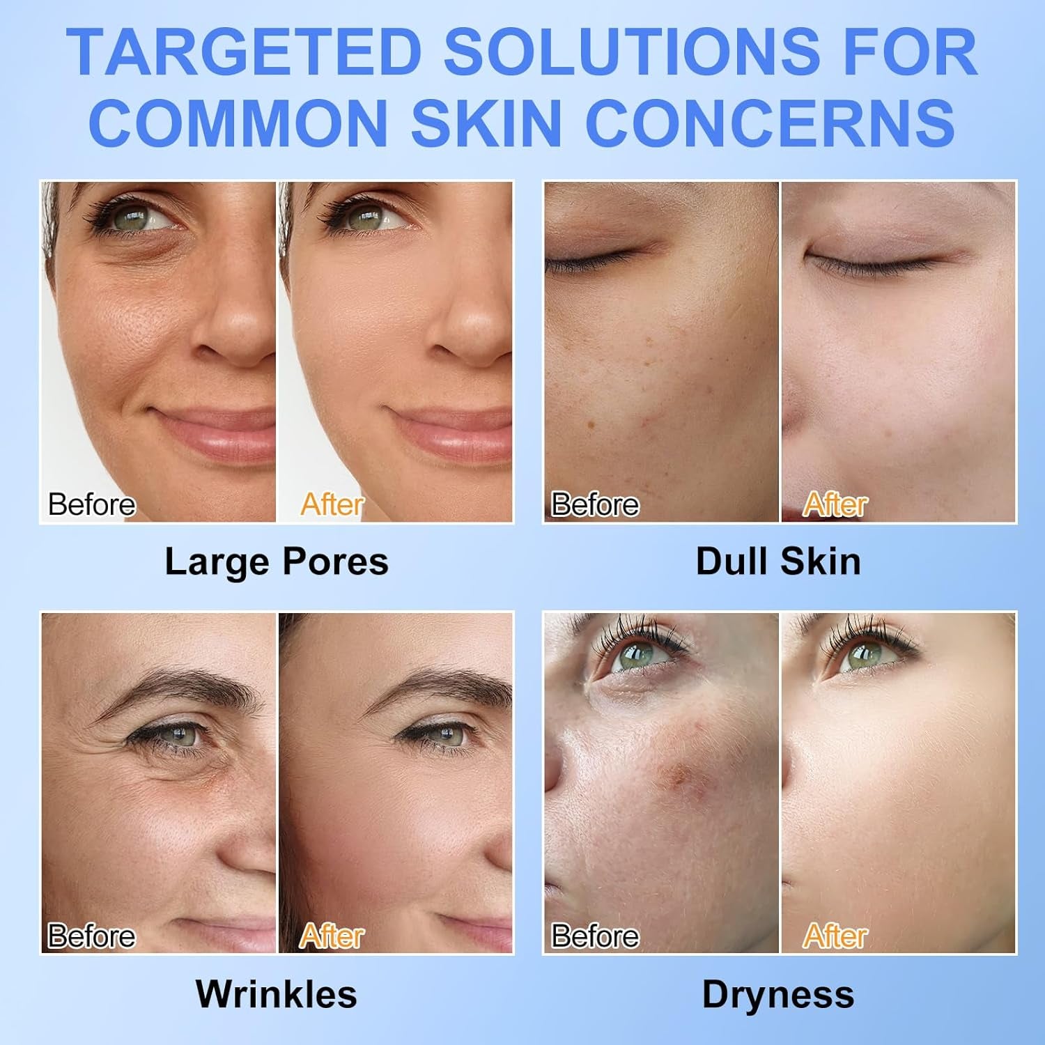 Bio Collagen Face Mask- Moisturise, Firm & Enhance Skin Vitality (34G X 6Ea)