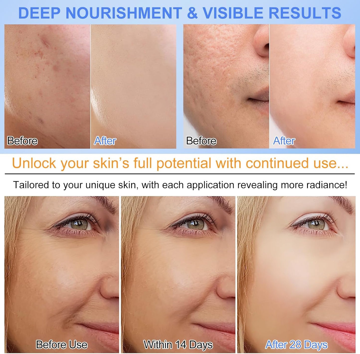 Bio Collagen Face Mask- Moisturise, Firm & Enhance Skin Vitality (34G X 6Ea)