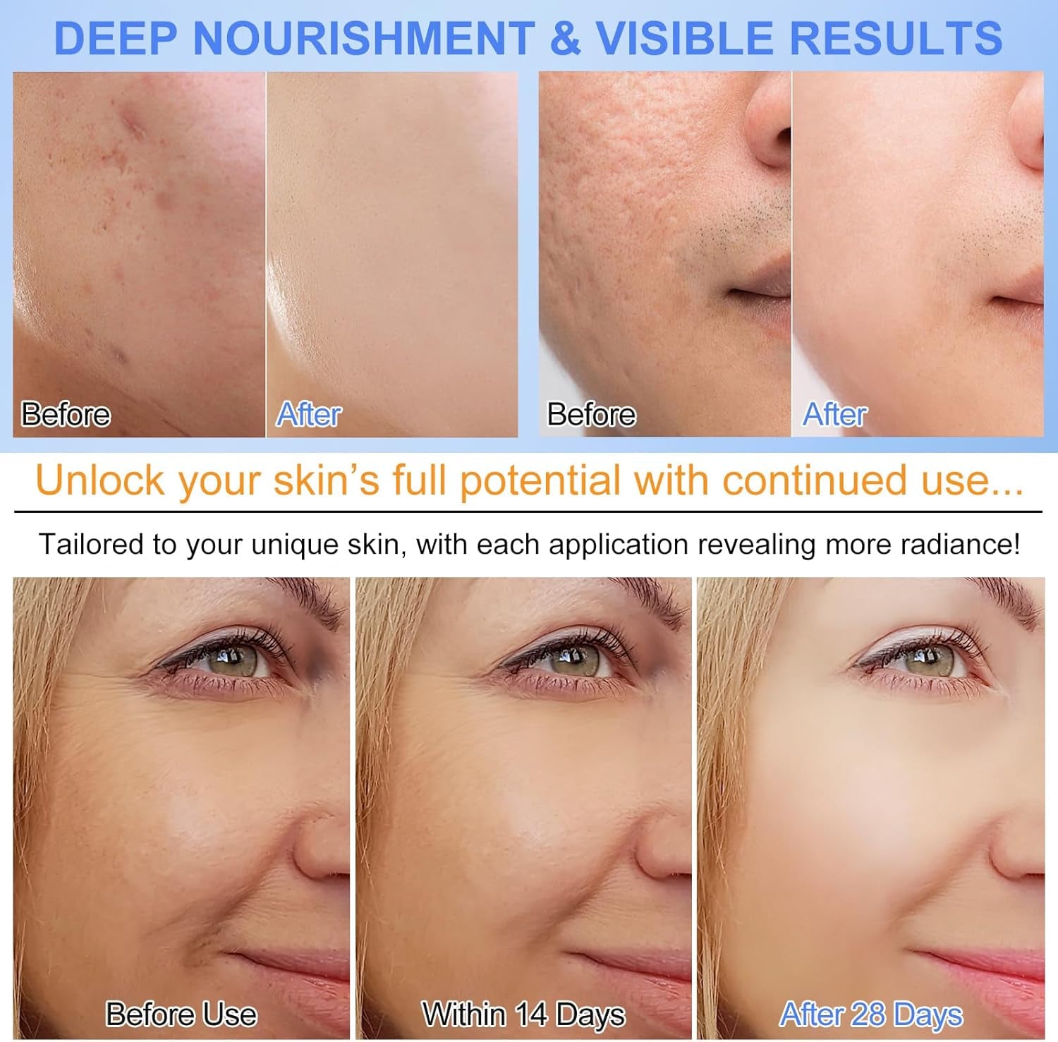 Bio Collagen Face Mask- Moisturise, Firm & Enhance Skin Vitality (34G X 6Ea)